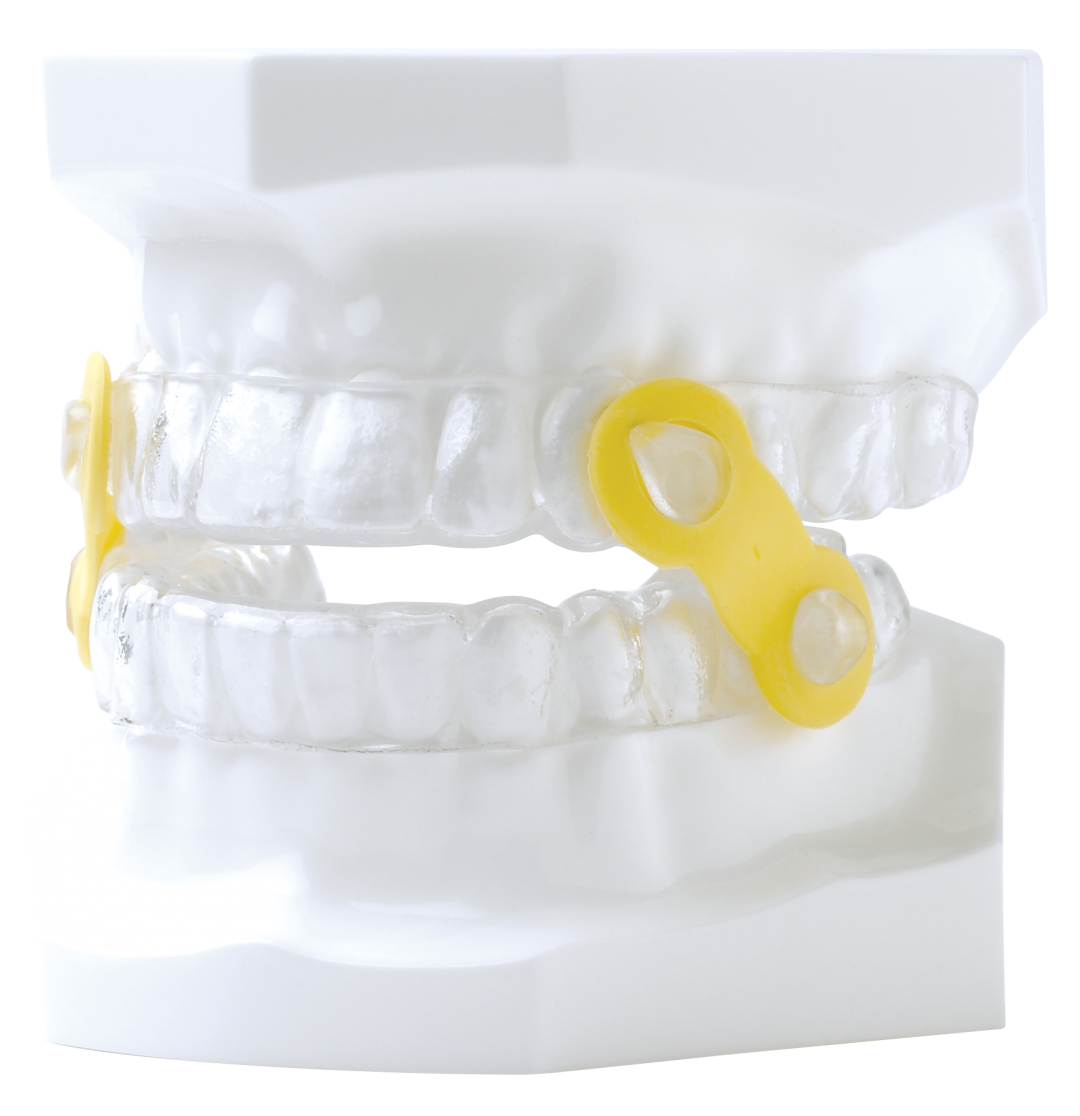 elastic mandibular advancement device